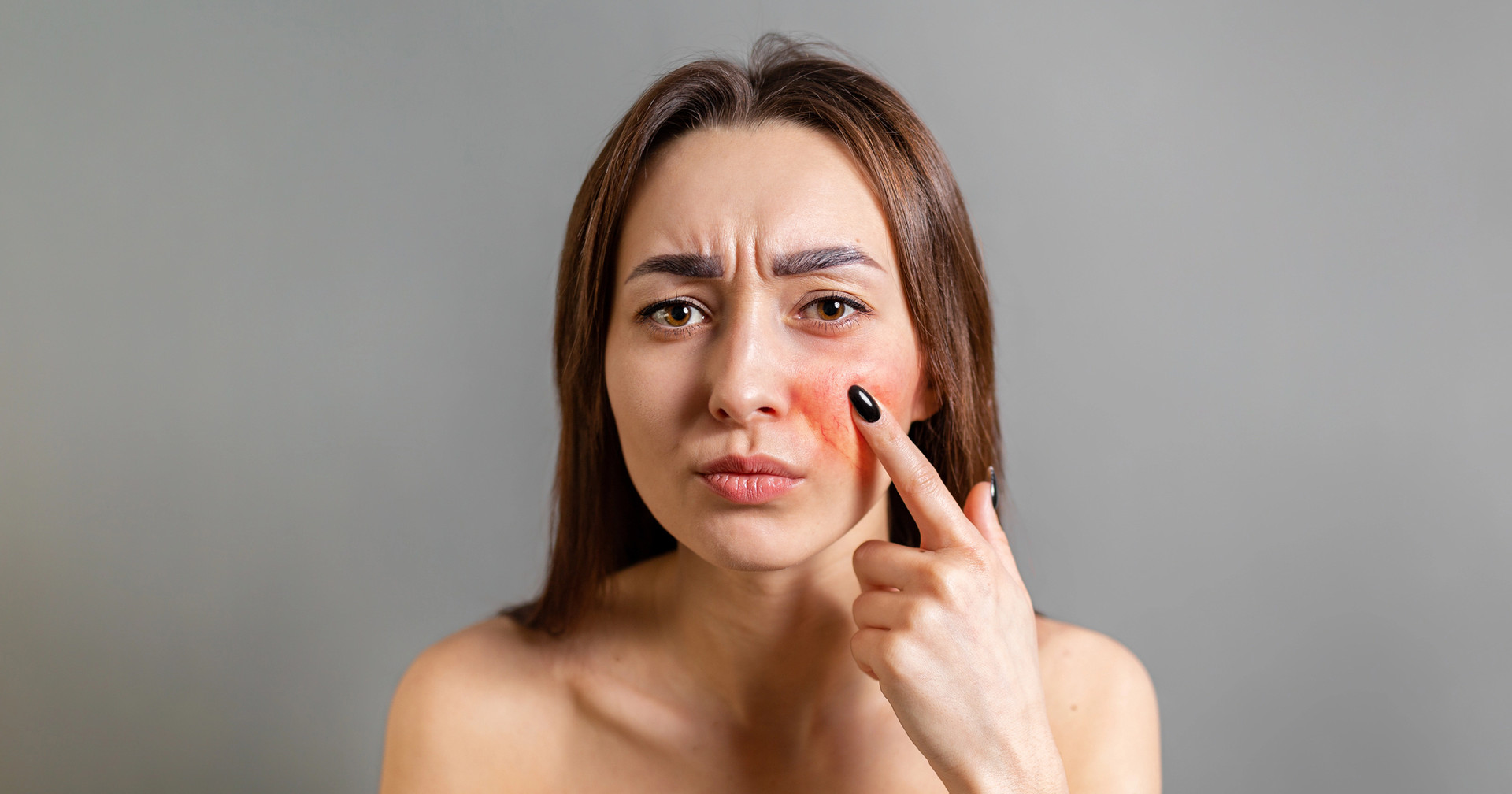 Može li začinjena hrana uzrokovati crvenilo i iritacije kože?